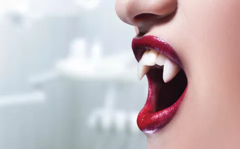 A person wearing vampire teeth.